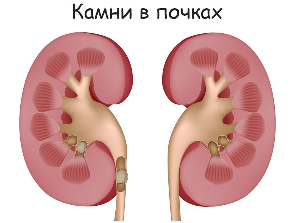 Кракен онион даркнет площадка